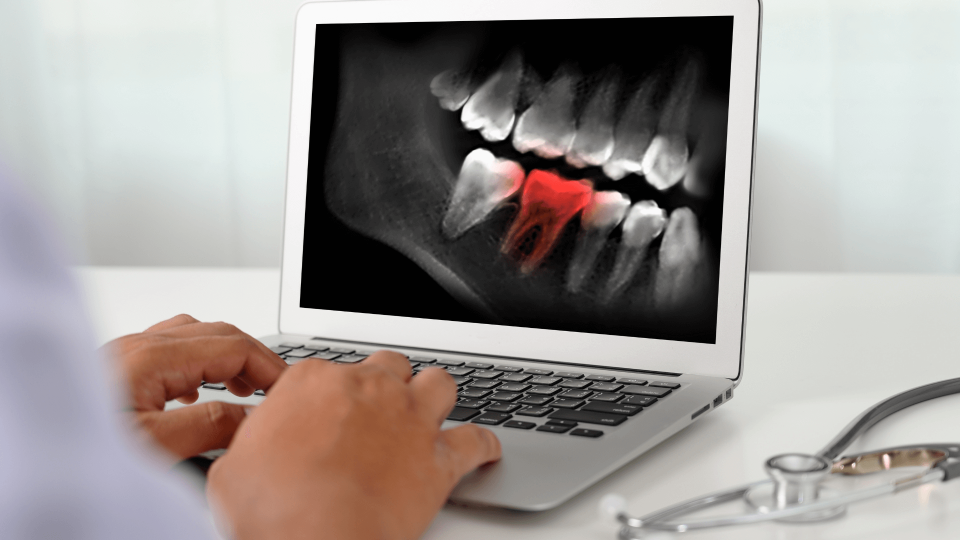 El Dr. Mariano Hernández en Onda Cero: sobre las radiografías dentales (II)