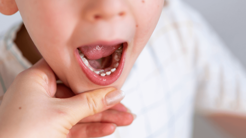 Odontopediatría