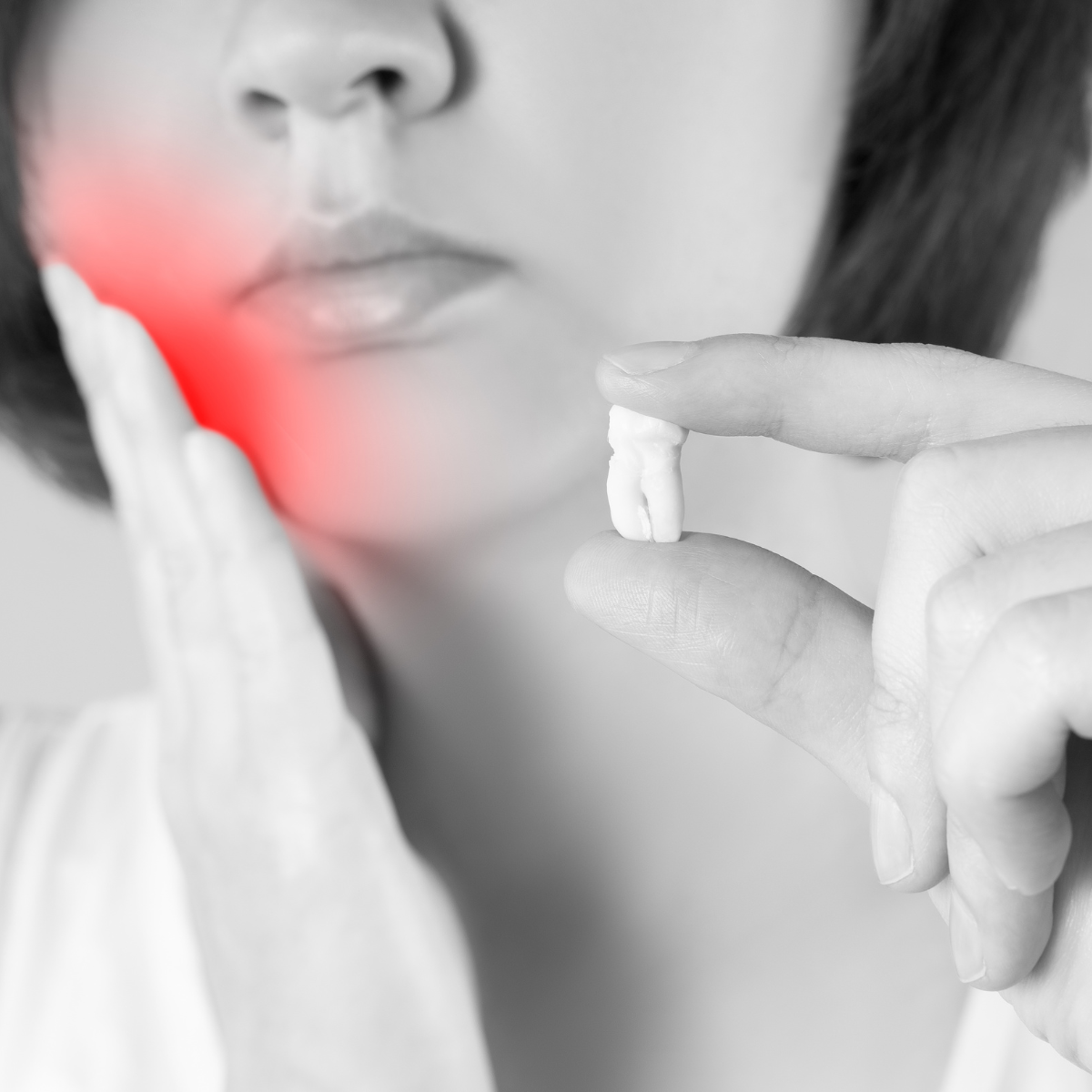 ¿Qué complicaciones puede tener una extracción dental?
