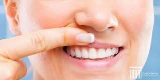 El esmalte dental El esmalte dental