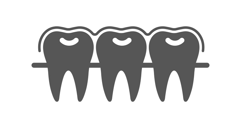¿Qué es la Ortodoncia Invisible? ¿Qué es la Ortodoncia Invisible?