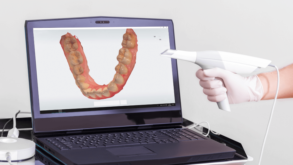 El Dr. Mariano Hernández habla del novedoso escáner dental Trios de 3Shape en Onda Cero.