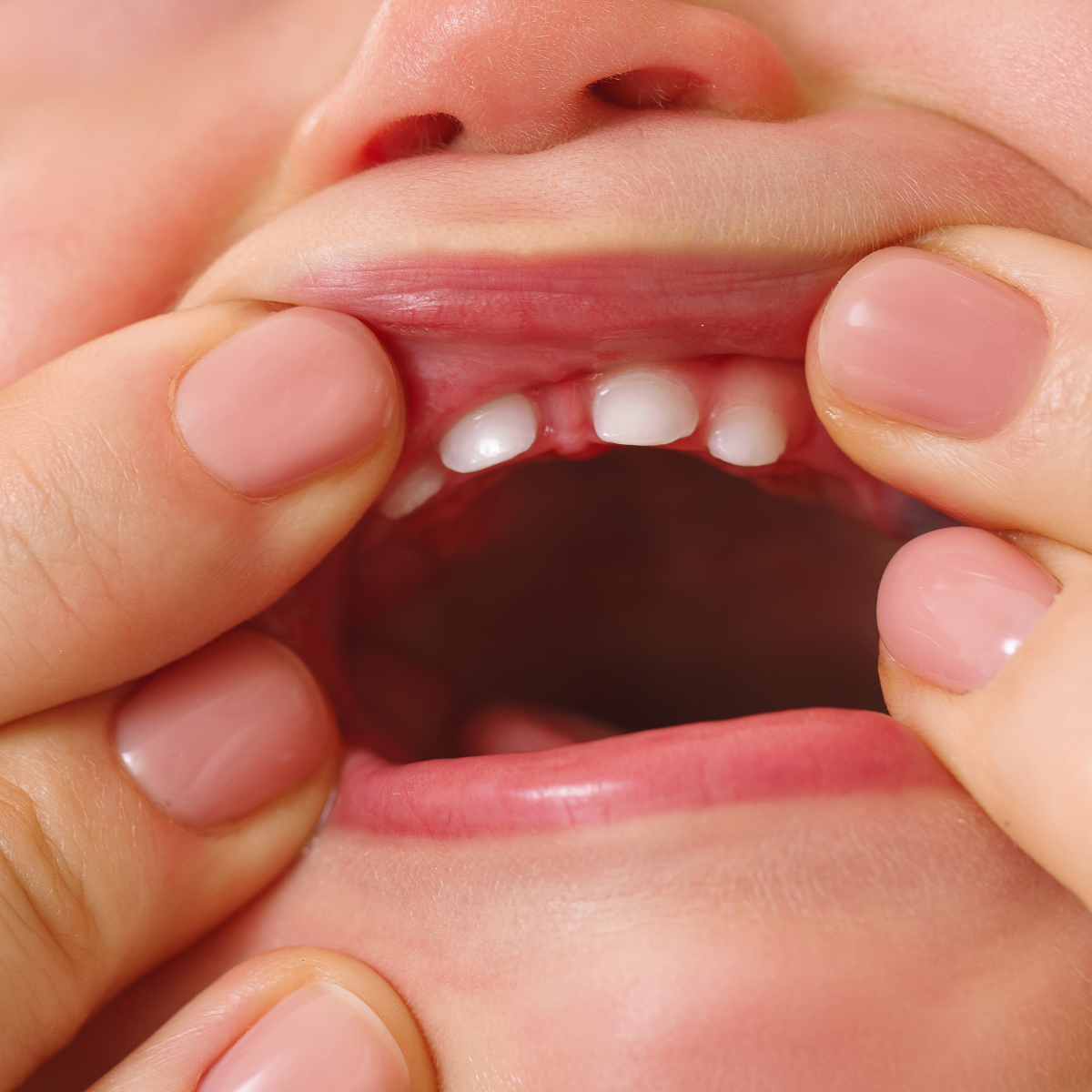 ¿Que nos aportan los dientes de leche? ¿Que nos aportan los dientes de leche?