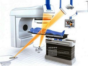 RADIOTERAPIA Y SALUD DENTAL RADIOTERAPIA Y SALUD DENTAL