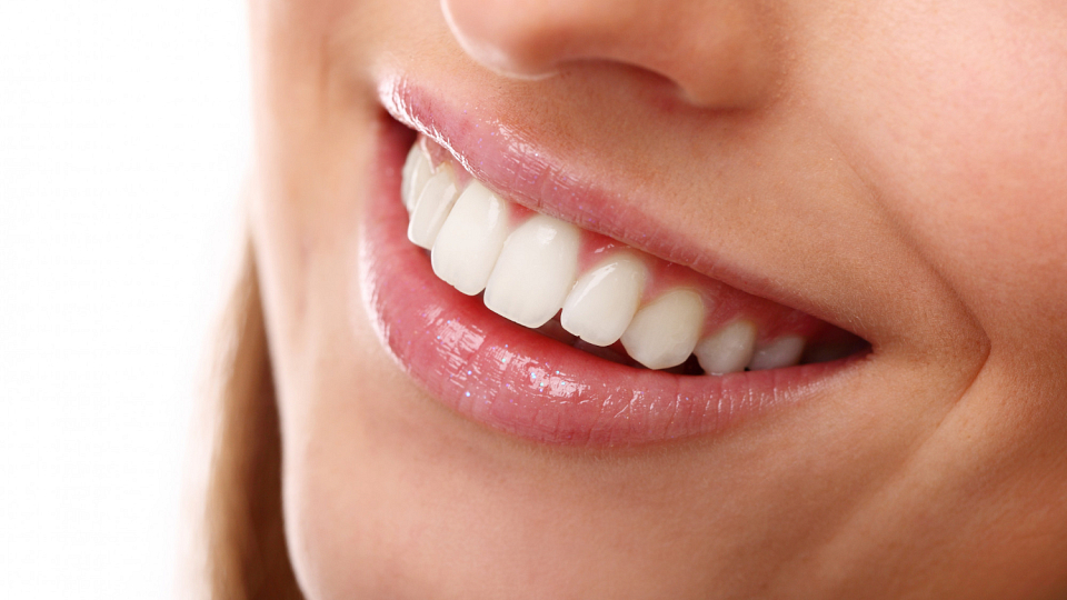 Blanqueamiento dental