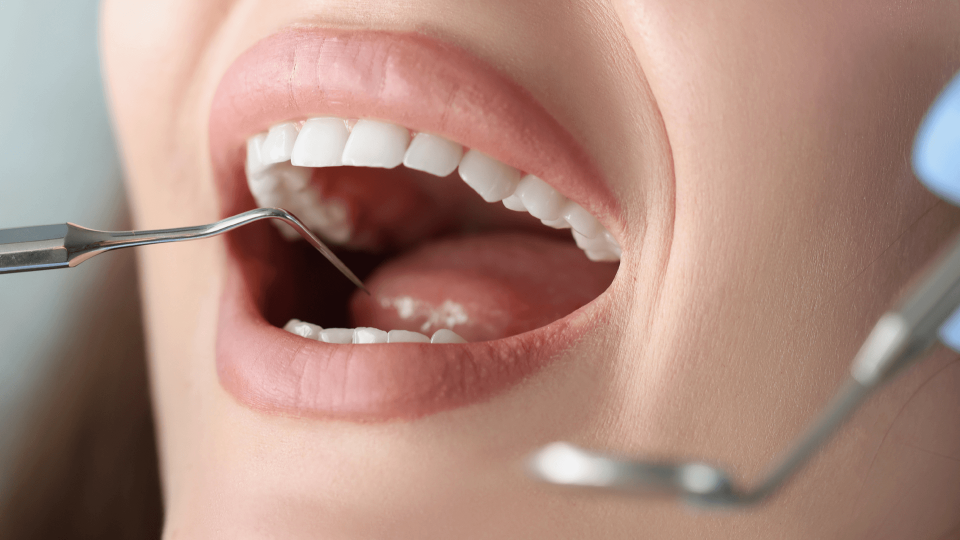 Entrevista sobre la higiene oral 2º