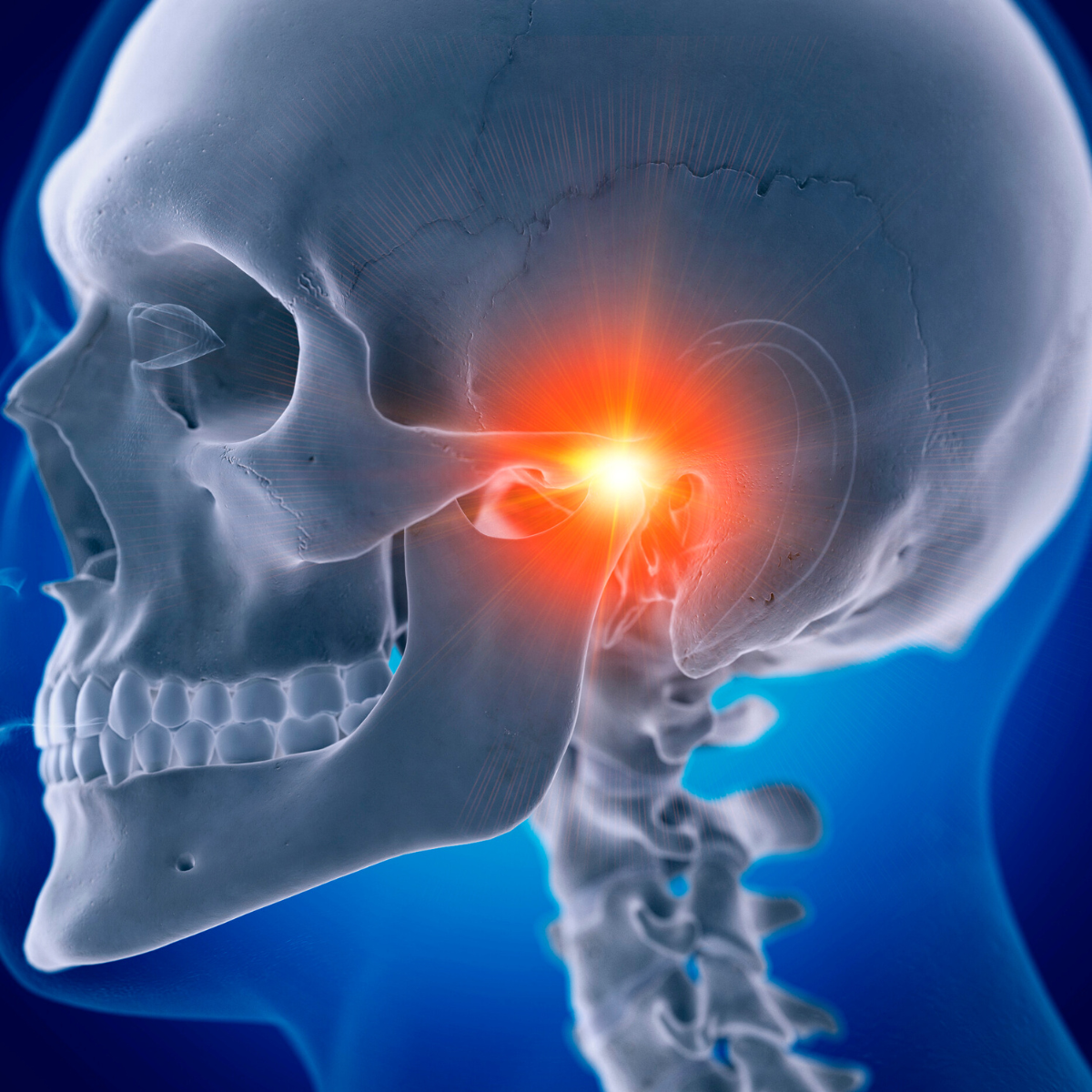 Recomendaciones higiénicas de la articulación temporo-mandibular Recomendaciones higiénicas de la articulación temporo-mandibular