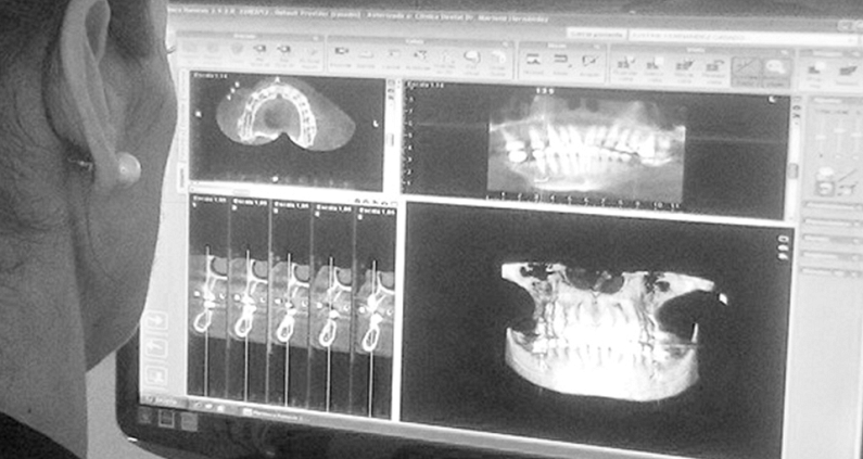 Impresión Digital Impresión Digital