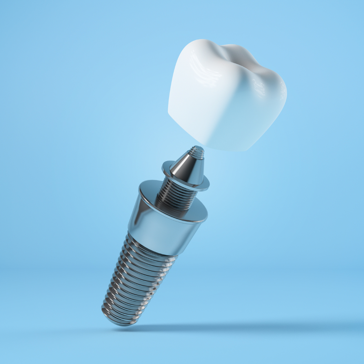 ¿Cómo puedo saber que tengo una perimplantitis? ¿Cómo puedo saber que tengo una perimplantitis?