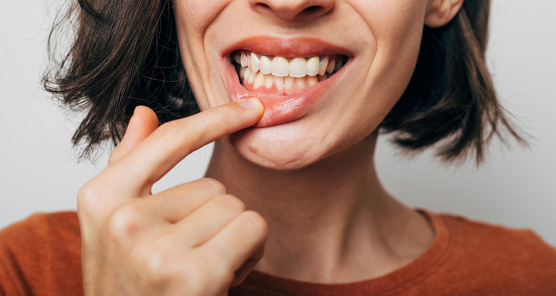 Transforma tu Sonrisa con Nuestras Carillas Dentales de Alta Calidad