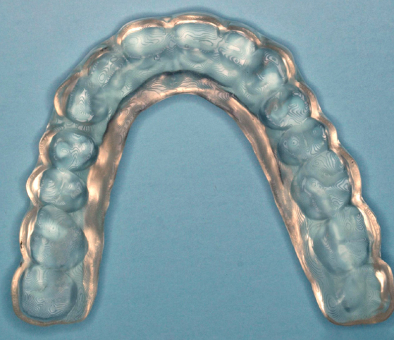 Sonriendo en cada etapa del proceso Sonriendo en cada etapa del proceso
