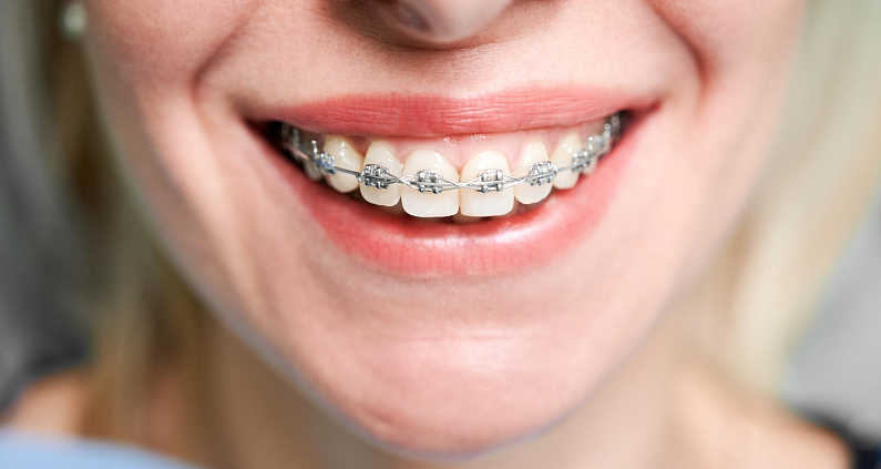 Buscamos tu mejor sonrisa