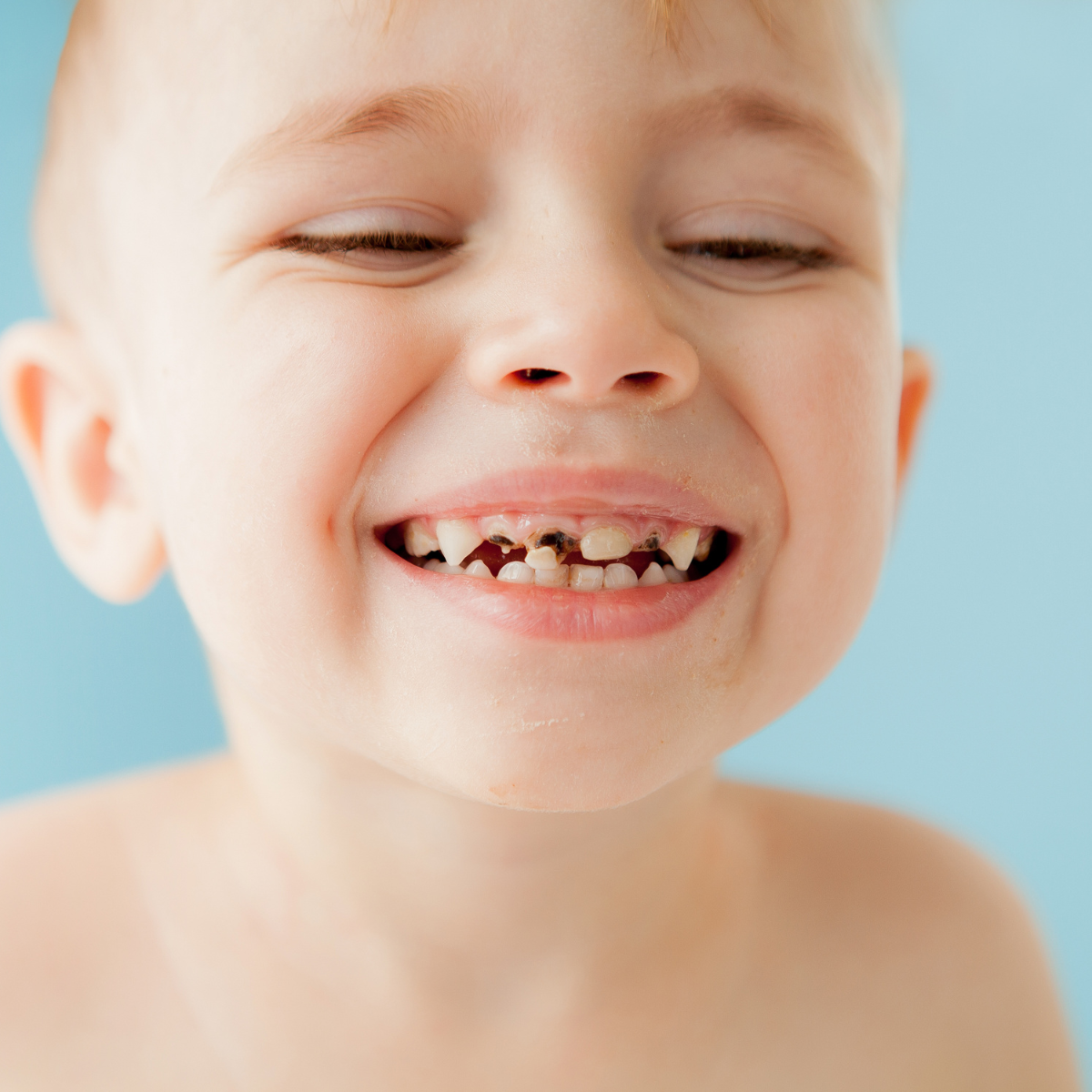 Cuidar la salud bucal desde la primera infancia