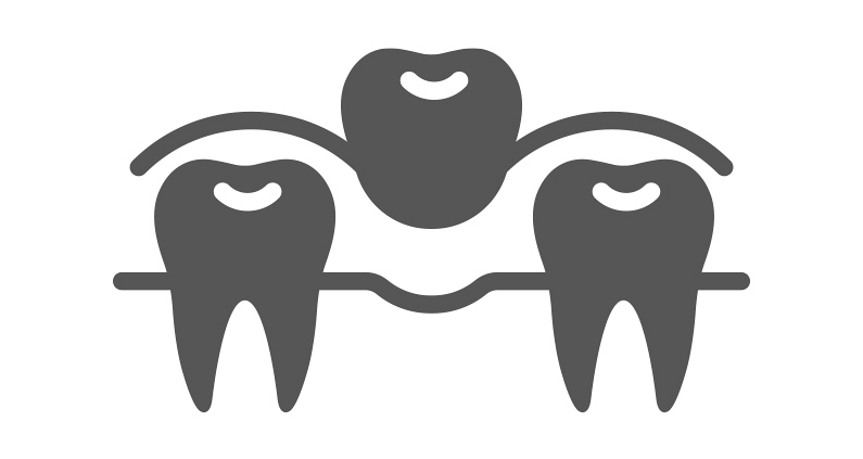 Prótesis Dental Prótesis Dental