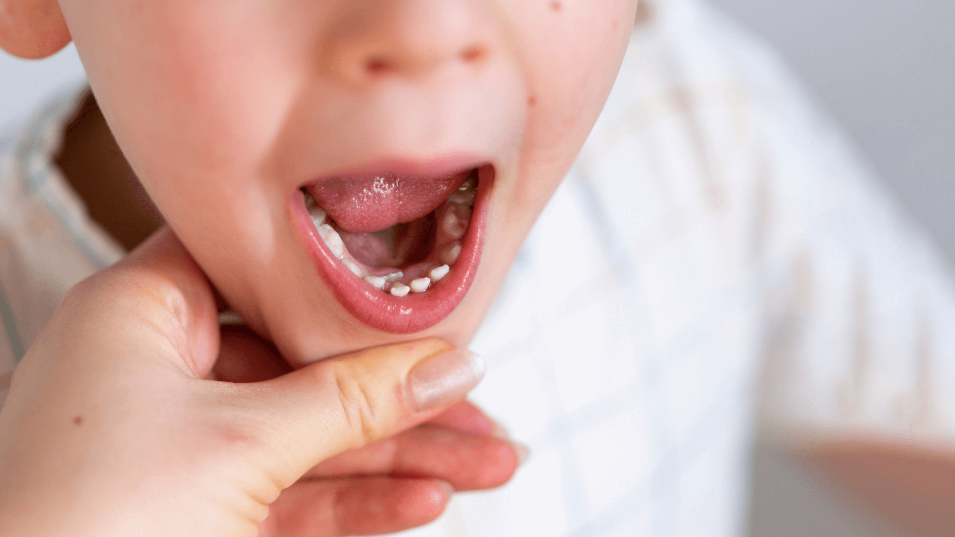 Dientes de leche Dientes de leche