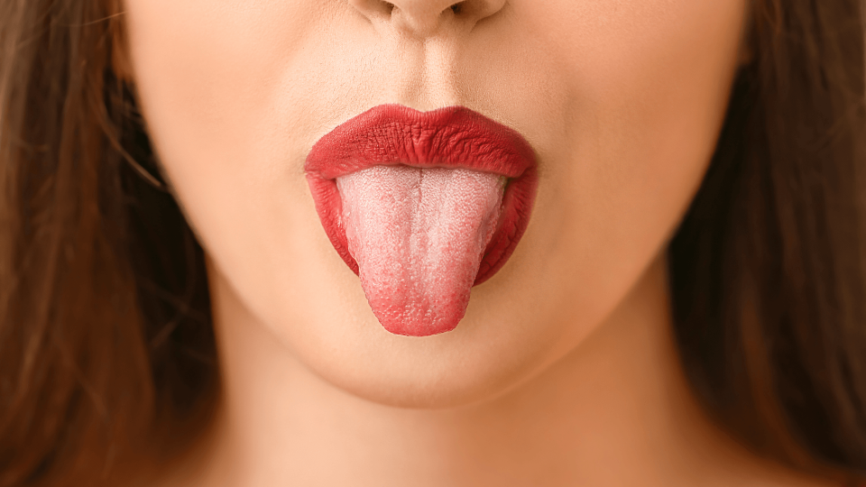 El Dr. Mariano Hernández y  los colores de la lengua para Onda Cero (II)