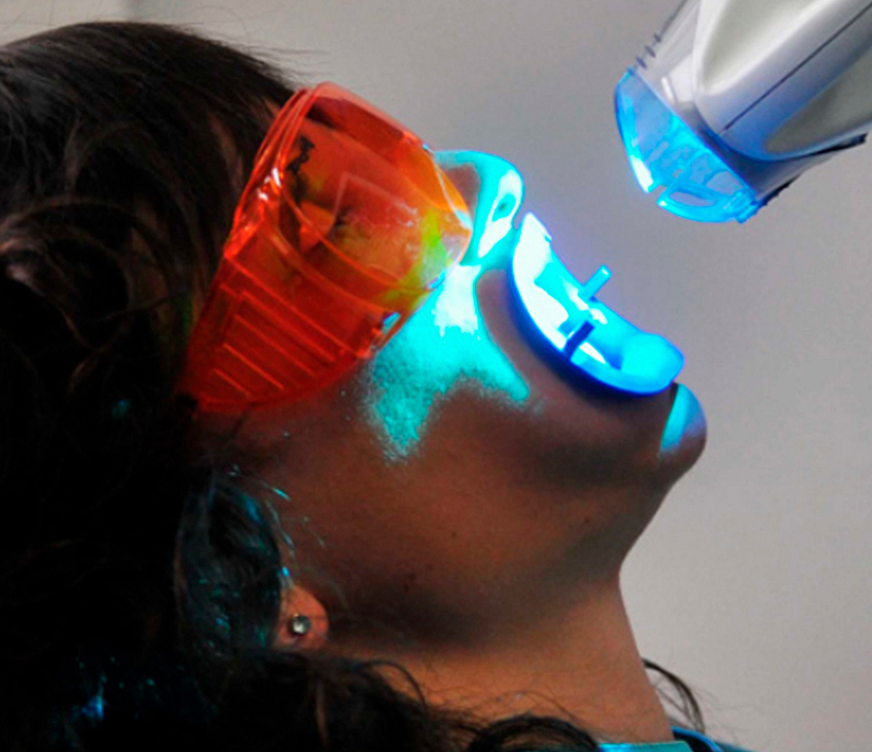 Recomendaciones para pacientes en tratamientos de blanqueamiento dental. Recomendaciones para pacientes en tratamientos de blanqueamiento dental.