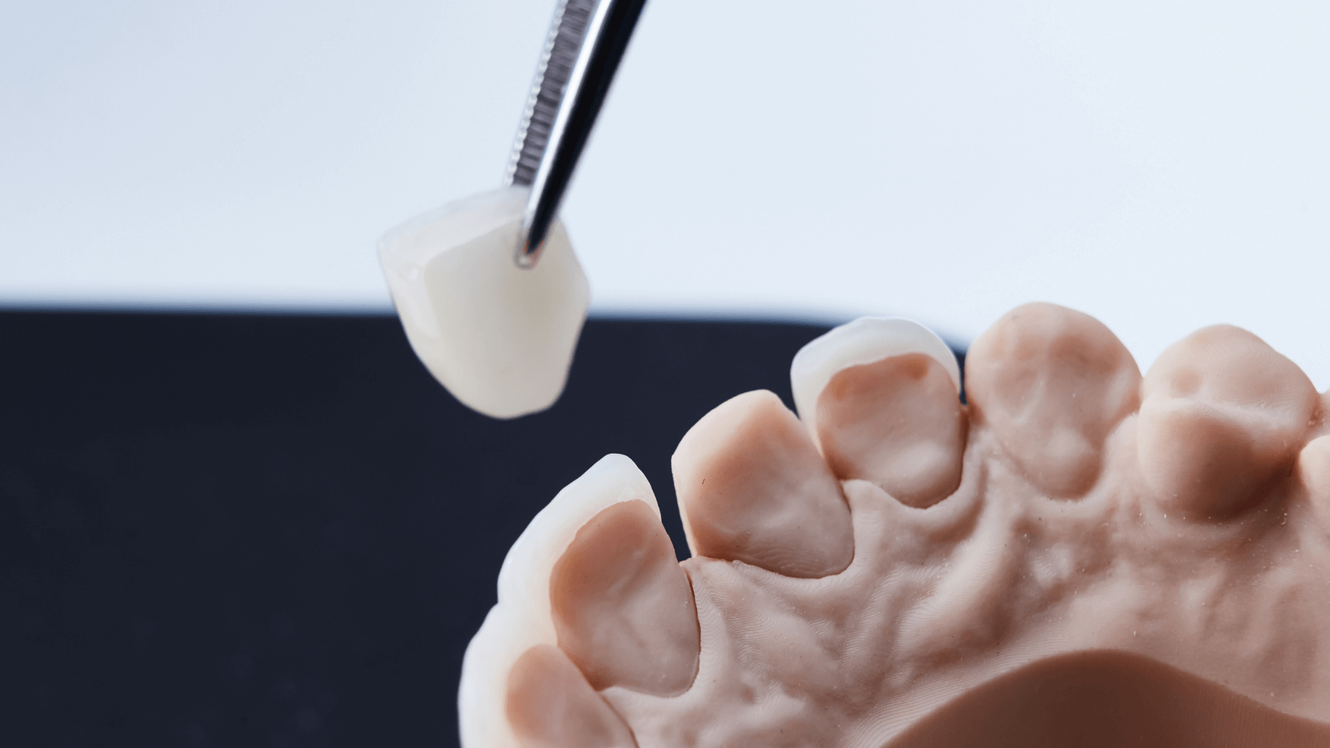 MICROCARILLAS DE PORCELANA.