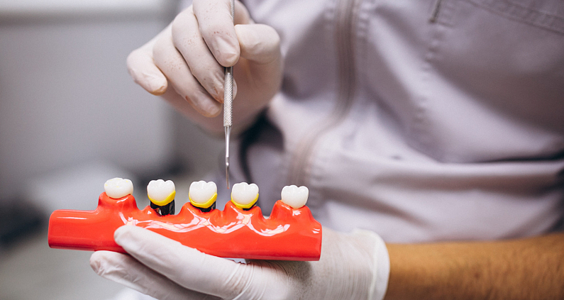 Recupera la Funcionalidad y Estética Dental con Nuestras Coronas