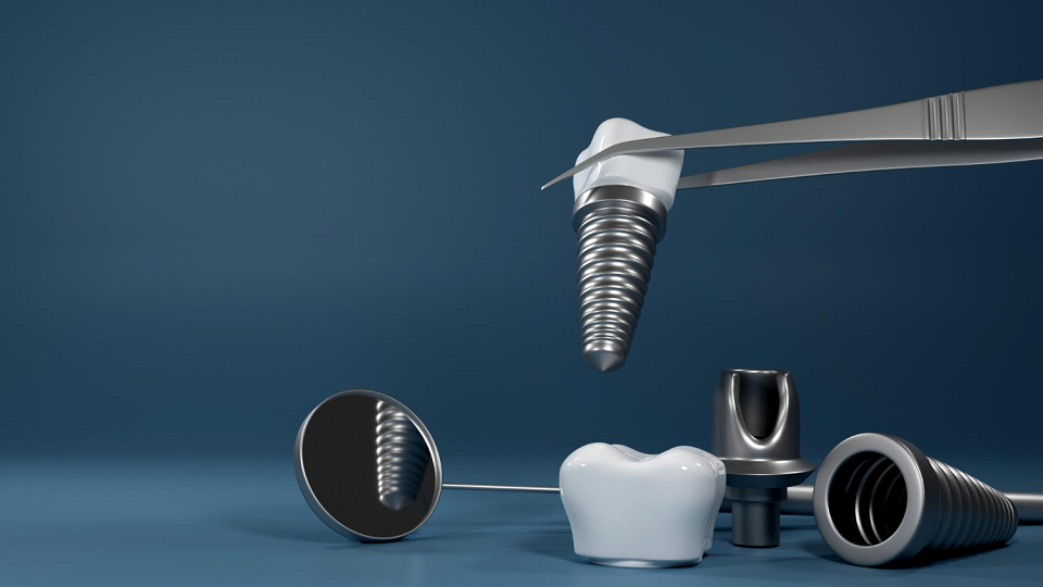 Implantes dentales