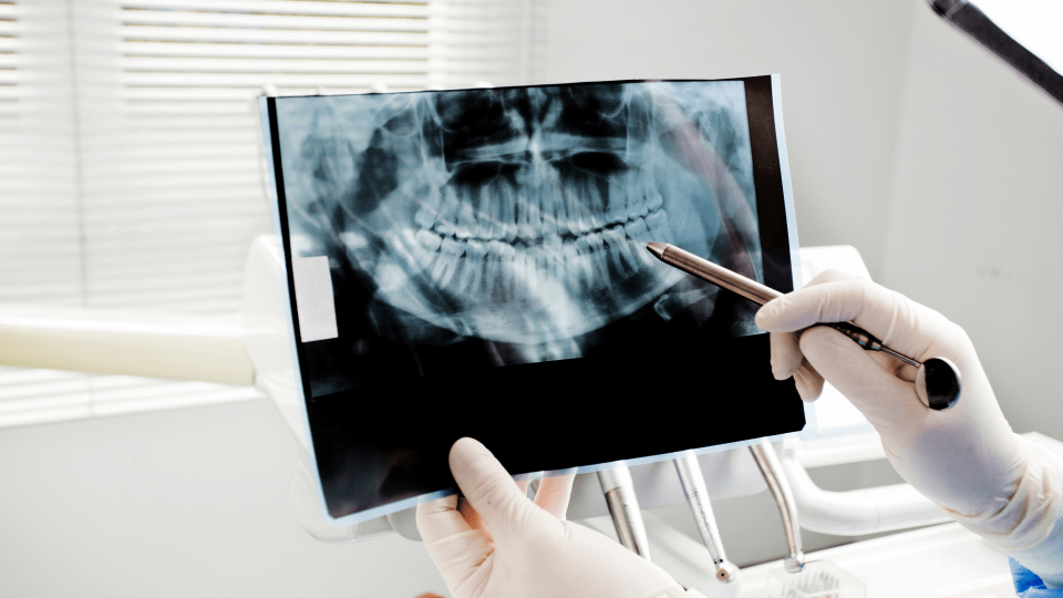 El Dr. Mariano Hernández en esta entrevista de Onda Cero continuamos hablando del desgaste dental.