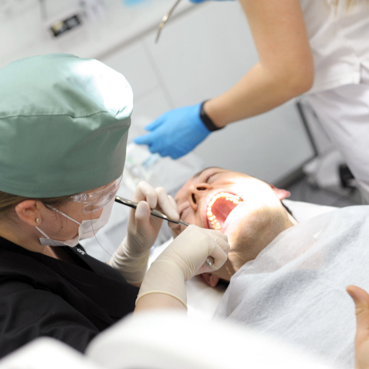 ¿Qué tipos hay de extracciones dentarias?