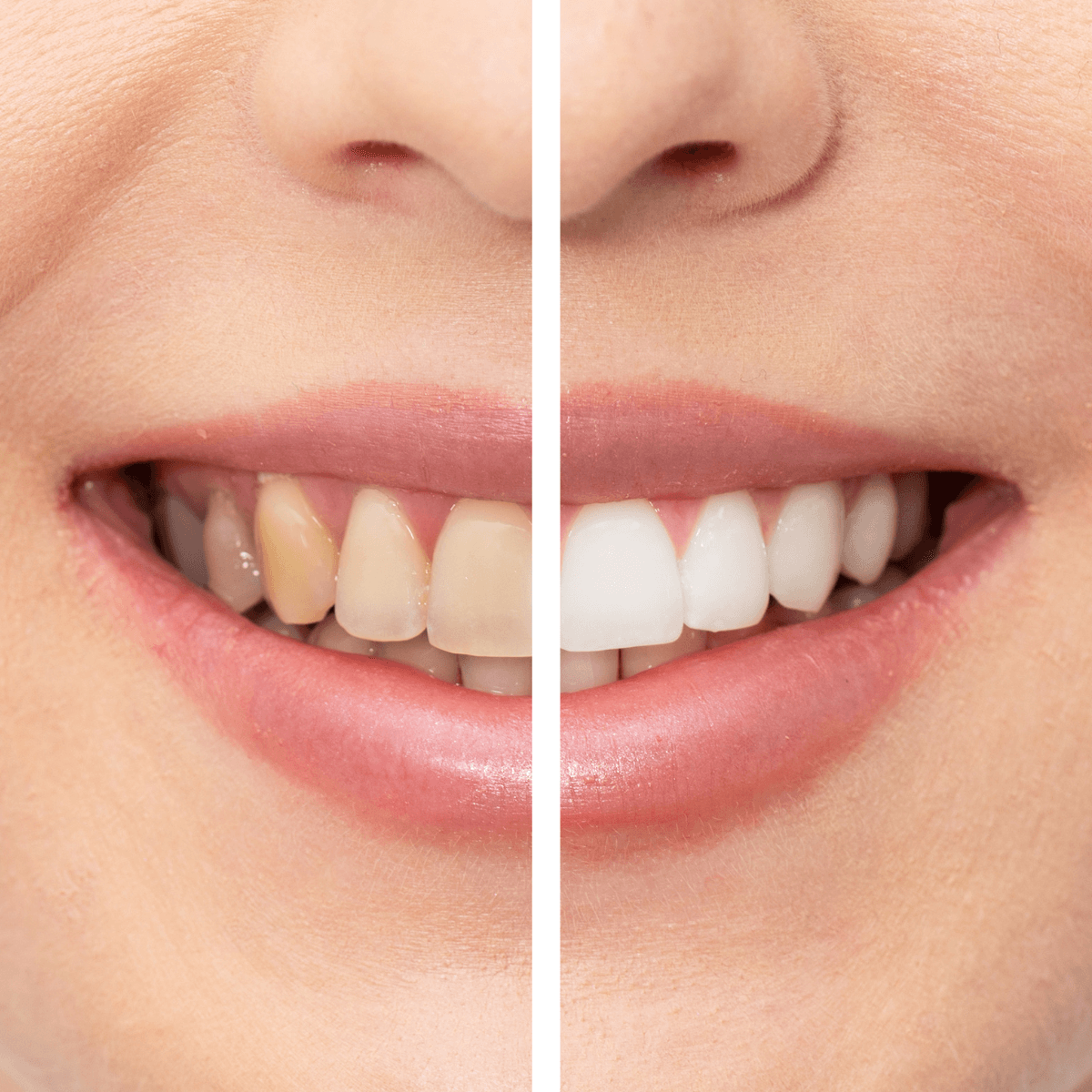 Bebidas que afectan al color de los dientes