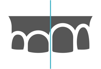 Alargamientos Coronarios