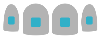 ¿En qué consiste la ortodoncia? Tipos de ortodoncia